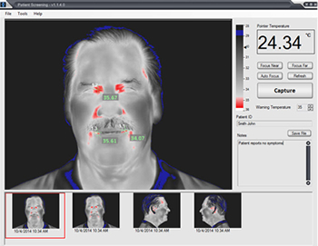 Fever Detection Cameras