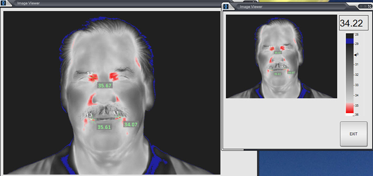 Fever Detection Cameras