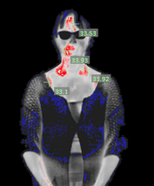 Fever Detection Camera