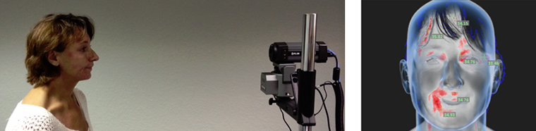 Infrared Fever Detection 