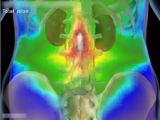 medical-thermography-back-large